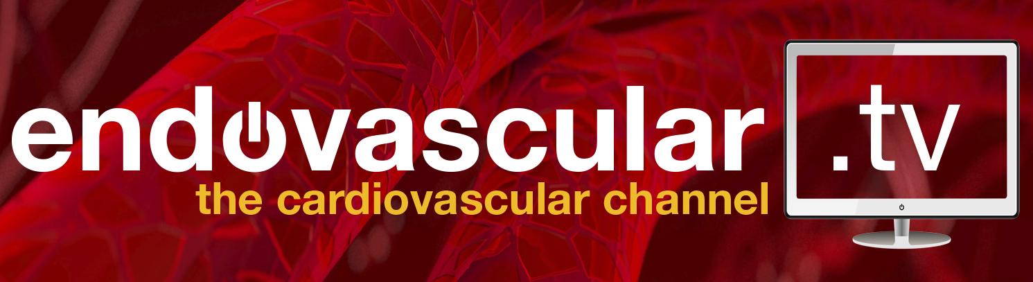 endovascular.tv