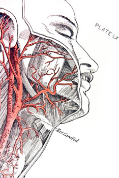 carotida