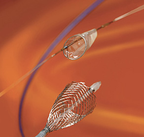 stent filtro carotida